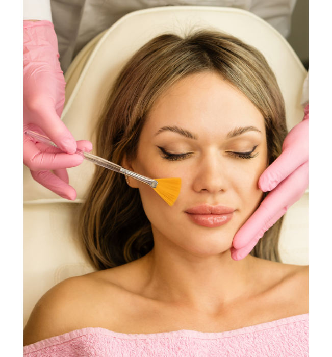 chemical peel surrey